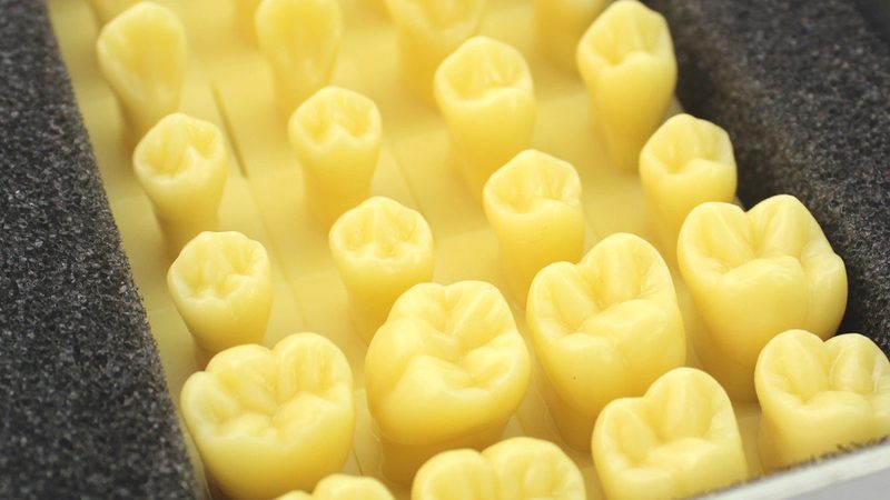 补牙后多久刷牙最合适？揭秘恢复期的正确护理方法**