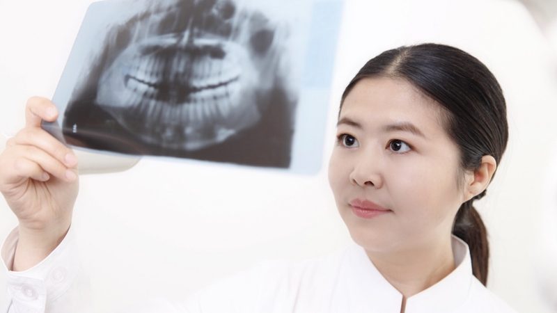 全口种植牙：了解allon4技术，告别缺牙烦恼