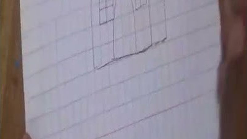 全口种植牙失败，背后原因有哪些？**